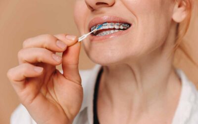 Cómo limpiarse los dientes si tengo brackets.